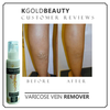 Image of VARICOSE VEIN REMOVER 100g  1PC 999 AND 2PCS GLUTA SOAP 500