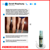 Image of VARICOSE VEIN REMOVER 2PC. 999 AND 2PCS SCAR SERUM 1500 W/FREE SOAP