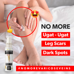 VARICOSE VEIN REMOVER 100g BUY 1 TAKE 1  1299 AND 2PCS SCAR SERUM LOTION W/FREE SOAP 1000